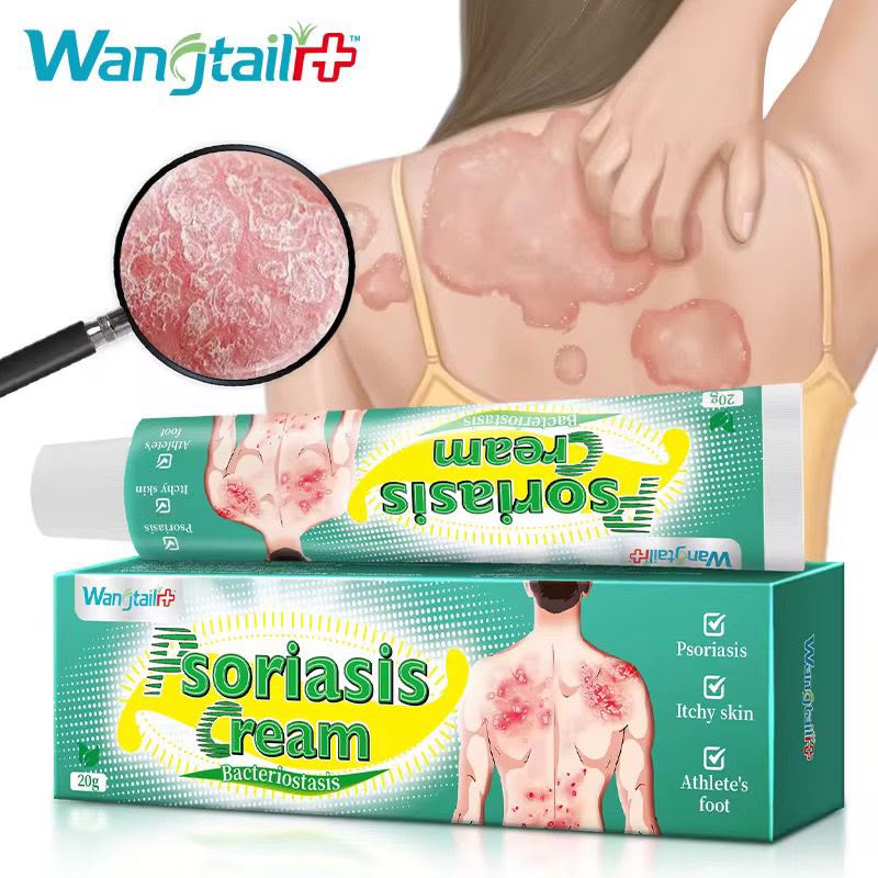 🌿✨ PSORIASIS CREAM – SOIN APAISANT POUR LA PEAU ✨🌿