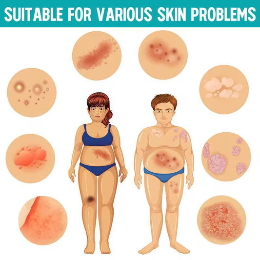 🌿✨ PSORIASIS CREAM – SOIN APAISANT POUR LA PEAU ✨🌿