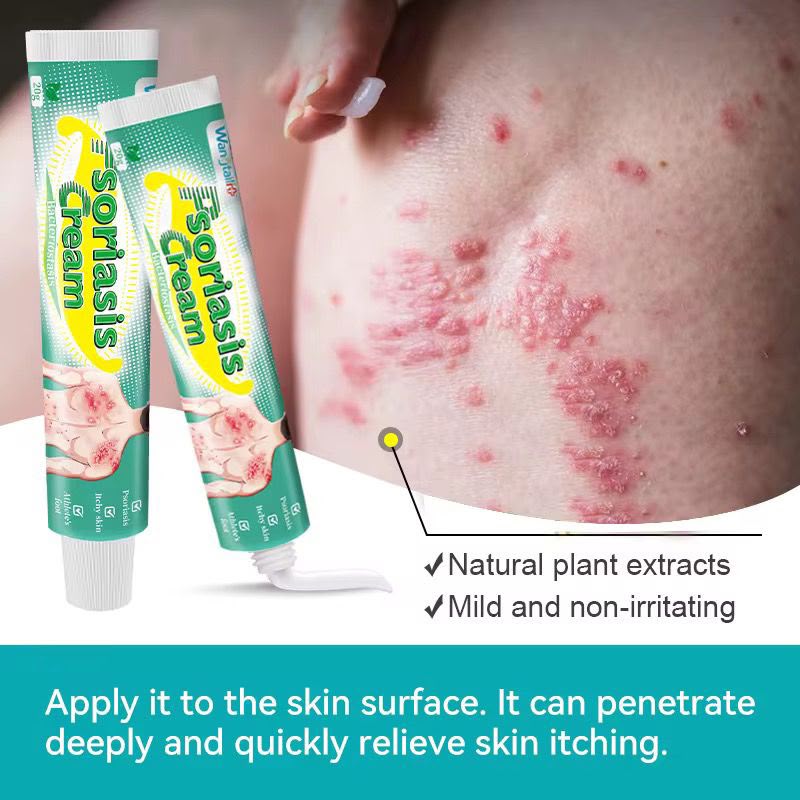 🌿✨ PSORIASIS CREAM – SOIN APAISANT POUR LA PEAU ✨🌿