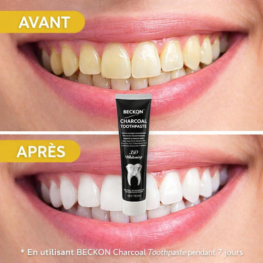 Dentifrice au Charbon Actif BECKON – Blancheur Intense